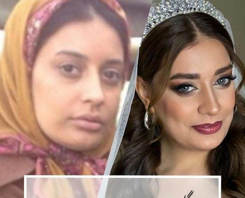 عکس گلپری در اوای باران