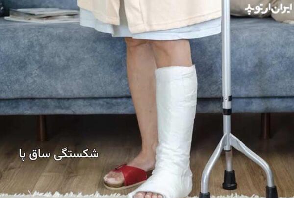 عکس پا شکسته دخترونه فیک