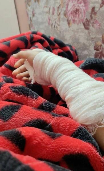 عکس پا شکسته دخترونه فیک