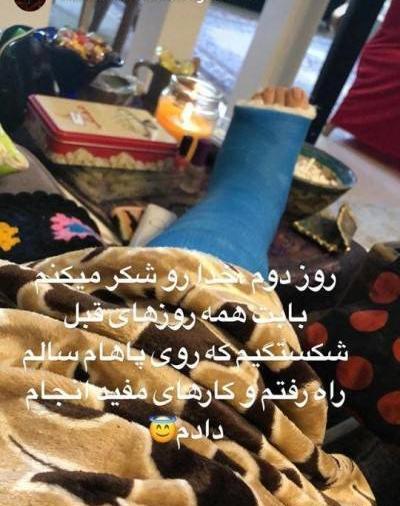 عکس پا شکسته دخترونه فیک