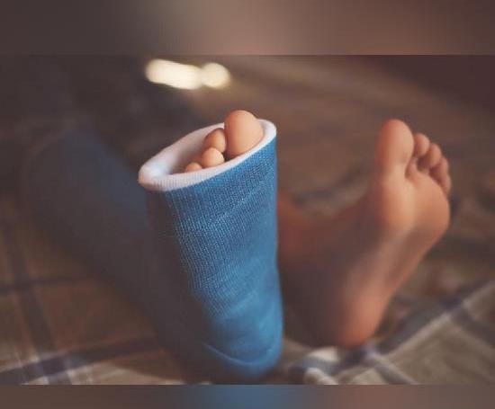 عکس فیک پای شکسته دخترونه