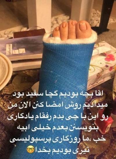 عکس فیک پای شکسته دخترونه
