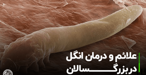 عکس دانه های سفید در مدفوع