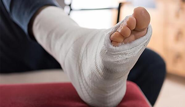 عکس پروفایل پای شکسته دختر