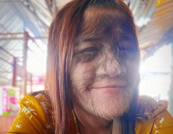 عکس دختر گرگ نما
