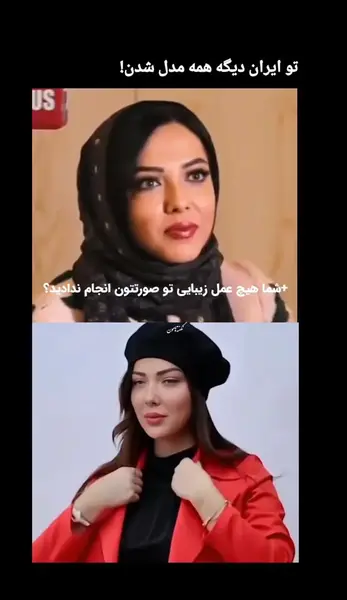 عکس های قبل عمل لیلا اوتادی