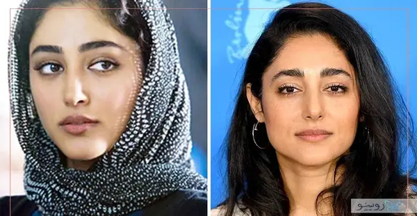 عکس های قبل عمل لیلا اوتادی