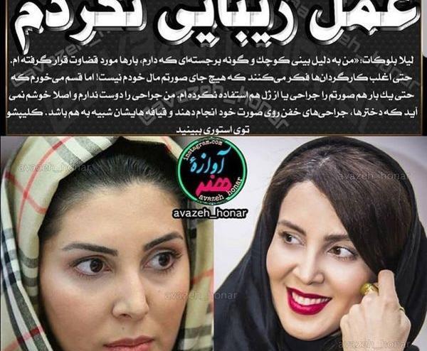 عکس های قبل عمل لیلا اوتادی
