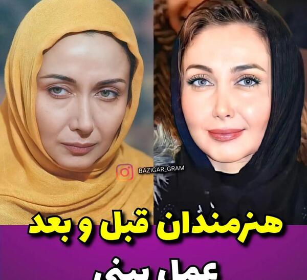عکس قبل و بعد عمل لیلا اوتادی