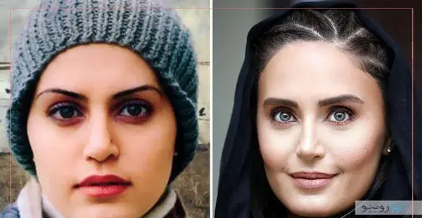 عکس قبل و بعد عمل لیلا اوتادی