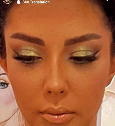 عکس قبل و بعد عمل لیلا اوتادی