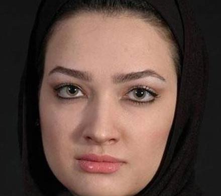 عکس قبل عمل ایدا حافظی