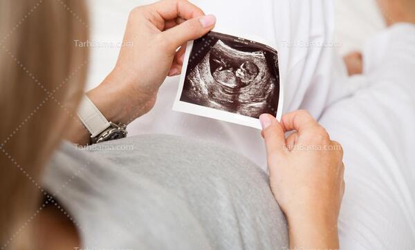 ایده عکس نوزاد با سونوگرافی