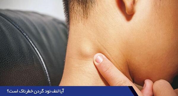منظور از عکس نود چیست