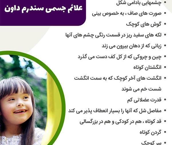 عکس کف دست نوزاد سندرم داون