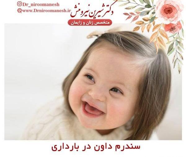 عکس نوزاد مبتلا به سندرم داون