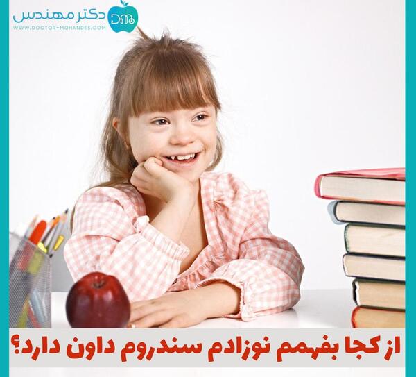 عکس نوزاد مبتلا به سندرم داون