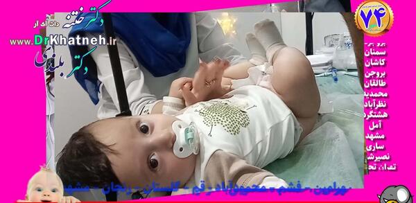 عکس نوزاد تازه ختنه شده