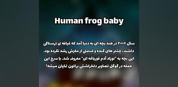 عکس نوزاد ادم قورباغه ای در هند