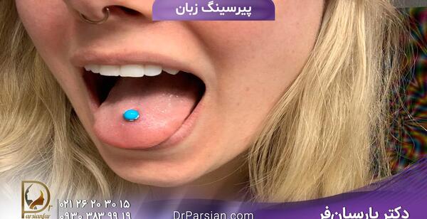 عکس عفونت پیرسینگ زبان