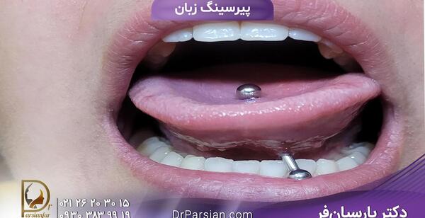 عکس عفونت پیرسینگ زبان
