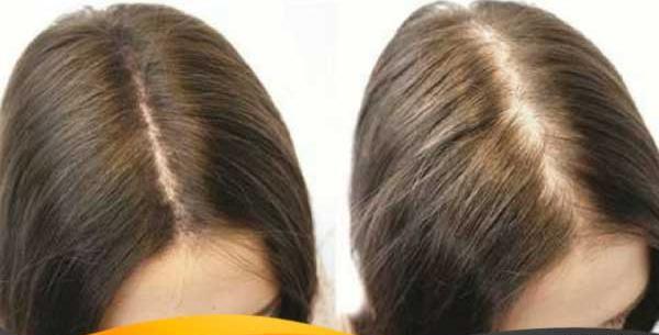 عکس تونیک هیر فرند بیز