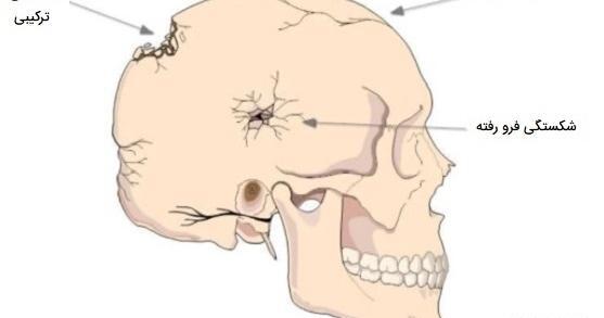 عکس اسکلت کله آدم