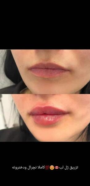 عکس ژل لب مدل سوتی نی نی سایت