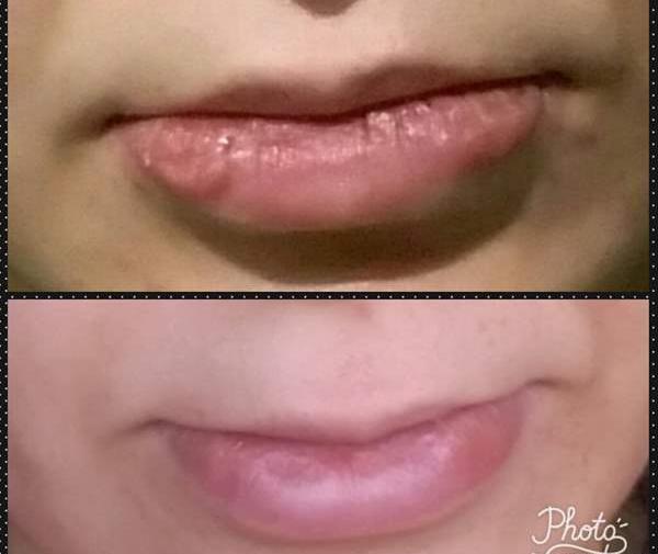 عکس ژل لب مدل سوتی نی نی سایت
