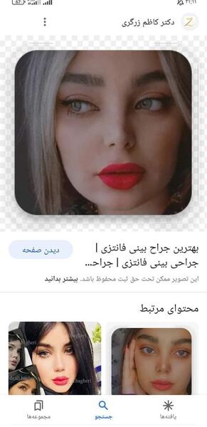 عکس بینیم بعد عمل نی نی سایت