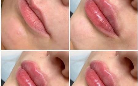عکس گلوله شدن ژل لب نی نی سایت