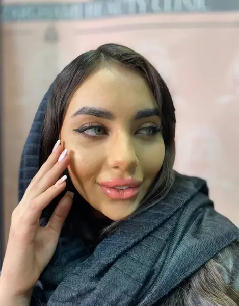 عکس گلوله شدن ژل لب نی نی سایت