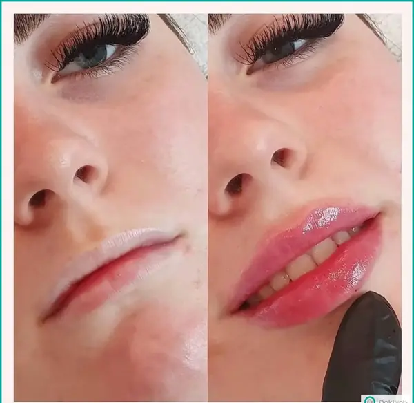 عکس گلوله شدن ژل لب نی نی سایت