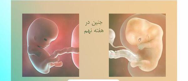 عکس جنین 90 روزه