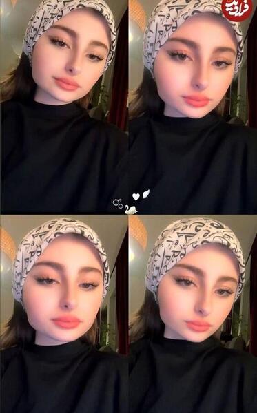 عکس قبل عمل سارا اسلامی