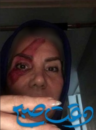 عکس تتوی مادر تتلو