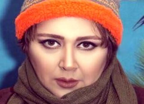 عکس قبل از عمل شهره لرستانی