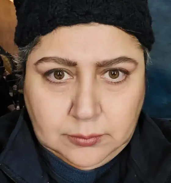 عکس قبل از عمل شهره لرستانی