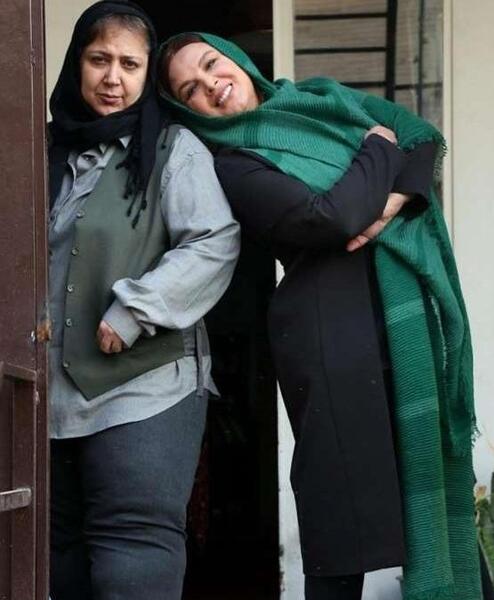 عکس قبل و بعد از عمل شهره لرستانی