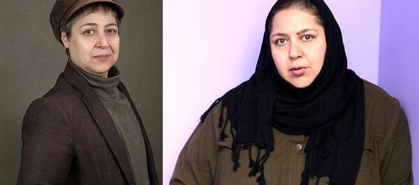عکس قبل و بعد از عمل شهره لرستانی