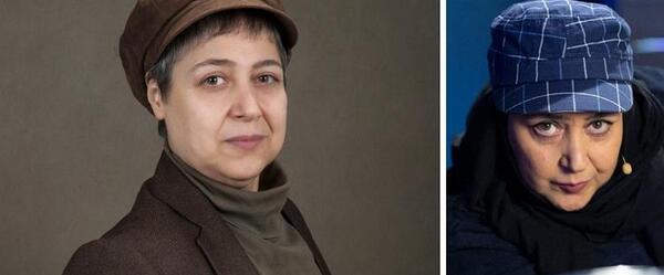 عکس قبل و بعد از عمل شهره لرستانی