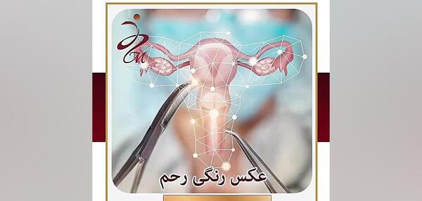 فیلم عکس رنگی رحم دوشاخ