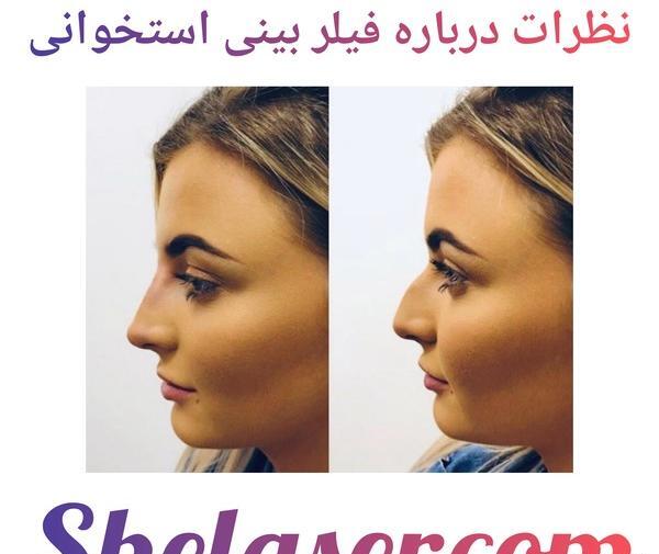 عکس های فیلر بینی