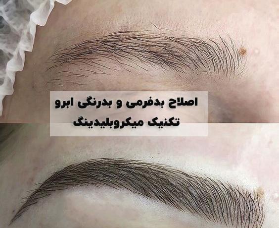 عکس میکروبلیدینگ ابرو پهن