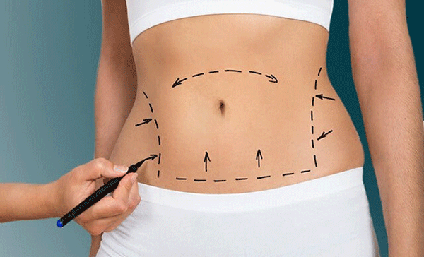 عکس طب سوزنی گوش