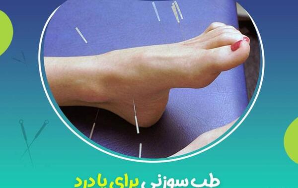 عکس طب سوزنی پا
