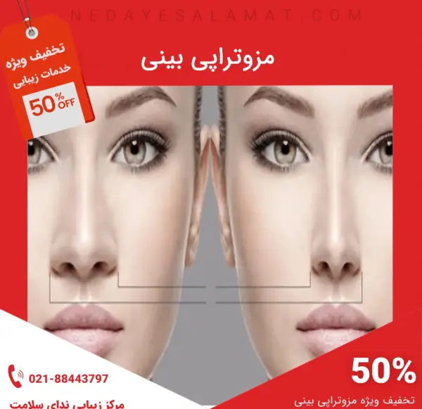 عکس قبل و بعد چربی سوزی بینی