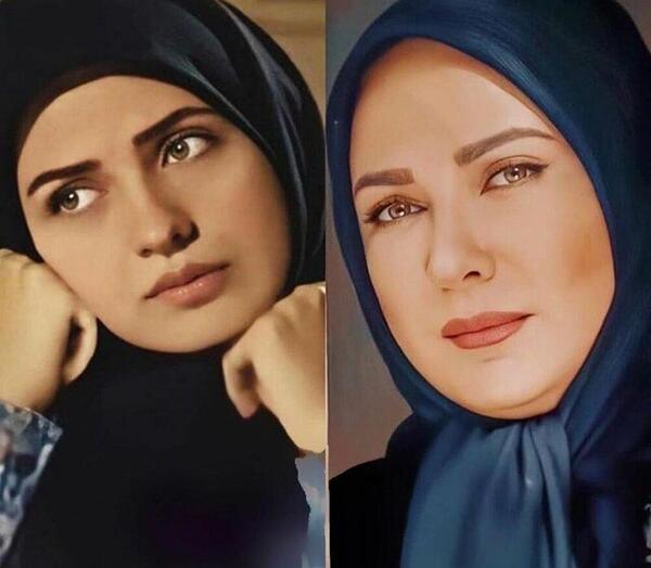 عکس لعیا زنگنه بعد از عمل زیبایی