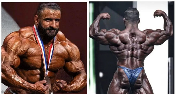 عکس رونی کلمن الان