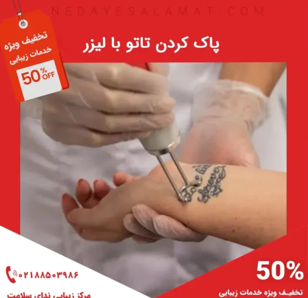 عکس دستگاه لیزر تاتو بدن